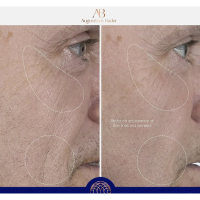 Сироватка для обличчя Augustinus Bader The Serum 7ml